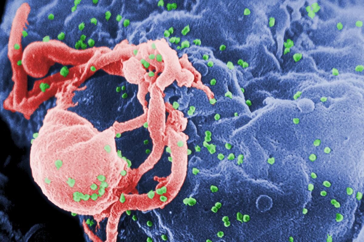 HIV virus